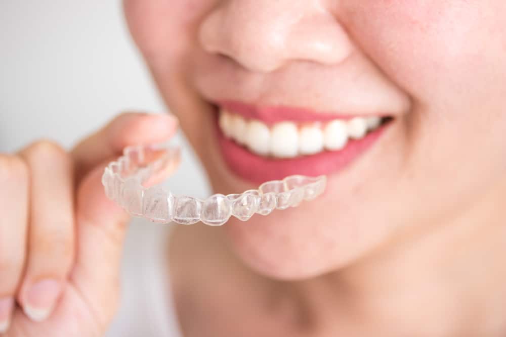 ClearCorrect Aligners in Mountain View, Wyoming ClearCorrect Clear Aligners Aligner Blacks Fork Dental Dentist in Mountain View Wyoming Dr. Devin Irene DDS